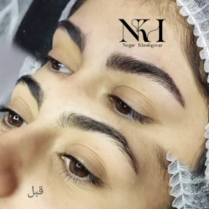 میکرو 1